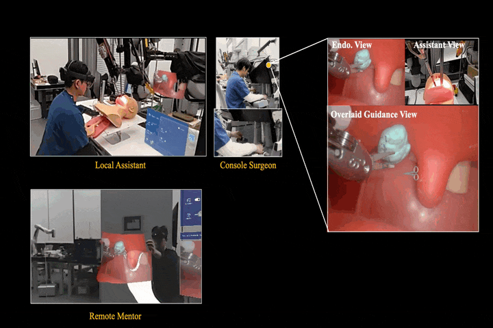 Extended Reality With HMD-Assisted Guidance and Console 3D Overlay for Robotic Surgery Remote Mentoring